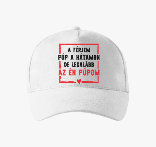 A férjem púp a hátamon de az é...