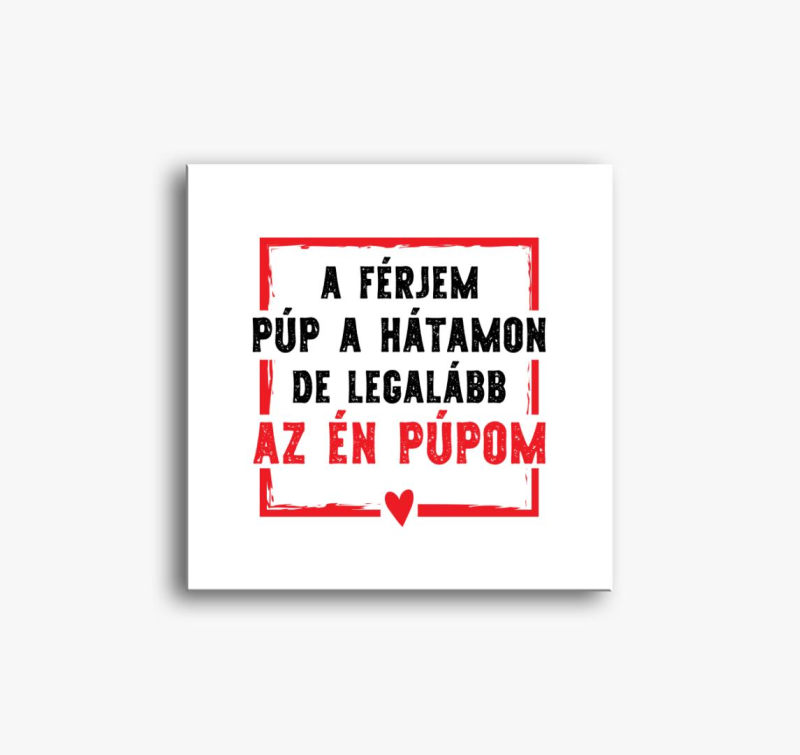 A férjem púp a hátamon de az én púpom páros vászonkép